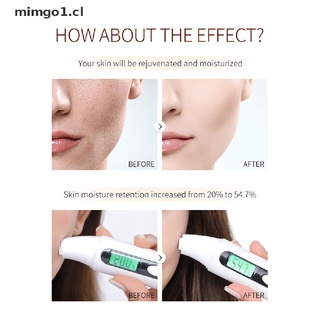 [mimgo1] laikou pro anti-envejecimiento suero anti arrugas suero facial blanqueamiento brigten tono de piel [cl]
