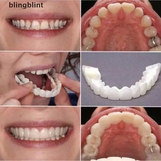 [blingblint] carillas de dientes superiores inferiores verdaderas tirantes snap onsmile dientes blanqueamiento dientes dentadura
