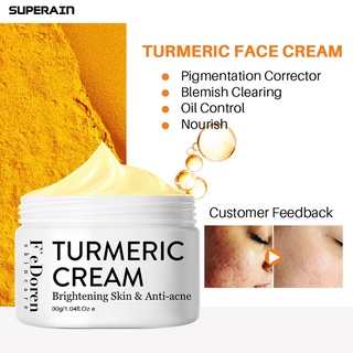 superain 30g crema facial piel nutritiva blanquear el acné cuidado de la piel hidratantes reparación de la crema para las mujeres (3)