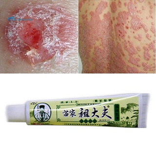 stock 20pcs herbal antibacteriano crema piel dermatitis picazón reparador ungüento