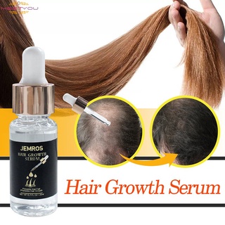 Rápido potente esencia de crecimiento del cabello Anti-pérdida de cabello aceite esencial tratamiento líquido prevenir la pérdida del cabello cuidado del cabello (1)