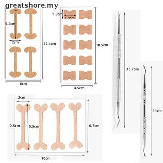 [Greatshore] corrector de uñas encarnado dedo del pie/pinza para uñas pedicura manicura/herramienta de cuidado de pies [MY]