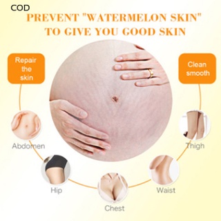 [cod] removedor de estrías maternidad piel crema corporal embarazo cicatrices removedor caliente