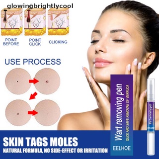 [gbc] 11g eliminación contra moles removedor anti verruca tratamiento de plumas líquidas [glowingbrightlycool]