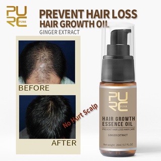 Esencia de crecimiento del cabello avanzada adelgazamiento del cabello y pérdida de cabello suplemento 20ML libresuficiente