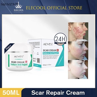 1 ALIVER Reparación Cicatriz Crema Eliminar La Marca Estirable Scald Cesarean Bump Cirugía 1 (1)