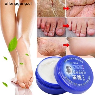LONGANG Hand Foot Crack Cream Heel Chapped Peeling Anti-dry Repair Moisturized 33g/85g .