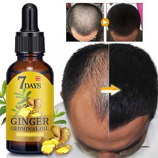 7 días aceite de jengibre tabletas 30ml anti-pérdida de cabello esencia daño reparación crecimiento cuidado del cabello esencia (7)