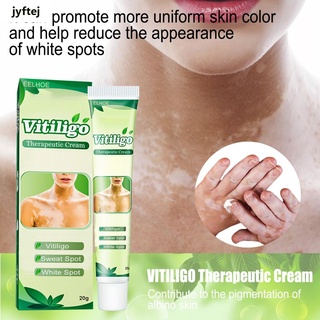 Ready White Tag Tratamiento Hidratante Crema Reduce Manchas Blancas Piel Vitiligo Cuidado Para Adultos 20g En stock