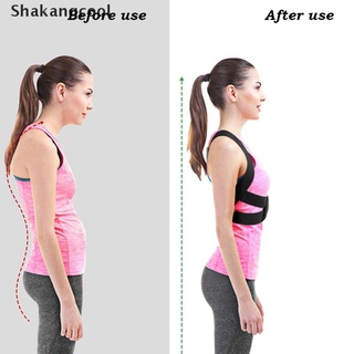 【SKC】 Support Belt Posture Corrector Corset Back Shoulder Lumbar Corrector Correction 【Shakangcool】