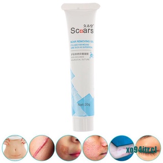 dreamhot*20G Scar Stretch Mark Removal Acne Treatment Ointment Gel Cream Skin Care
