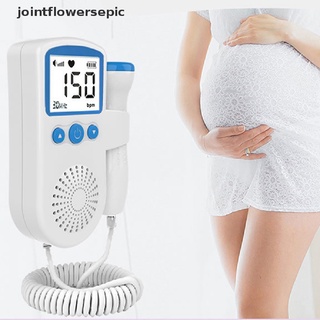 Nuevo Stock Upgrad 3.0MHz Doppler Fetal Monitor De Frecuencia Cardíaca En Casa Embarazo Sin Radiación Caliente