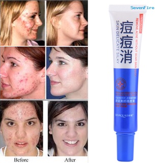 sevenfire bioaqua 30g acné comedo eliminación de espinillas retráctil poro hidratante crema para el cuidado de la piel