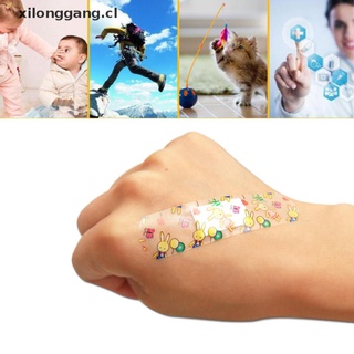 LONGANG 100PCS Waterproof Breathable Transparent Band Aid Hemostasis Plasters Emergency . (1)