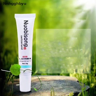 [Nnhgghbyu] Whitening Repair Remover Scar Stretch Acne Cream Birth Mark Face Treatment Hot Sale