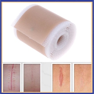 Efficient Beauty Scar Removal Silicone Gel Self-Adhesive Silicone Gel Tape Patch for Acne Burn Scar Reduce