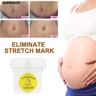 superain 100g agradable a la piel estrías removedor de mejora de la elasticidad de la piel líquido de maternidad cicatriz eliminación de arañazos suministros para embarazadas
