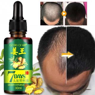 7 días aceite de jengibre tabletas 30ml anti-pérdida de cabello esencia daño reparación crecimiento cuidado del cabello esencia (2)