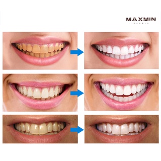 maxmin esencia blanqueadora de dientes removedor de manchas de limpieza dental cuidado oral (5)