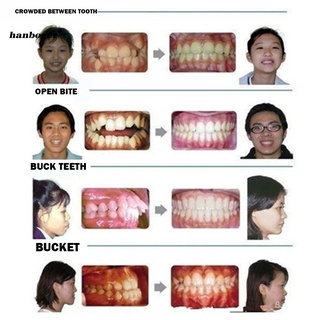 han_ bandeja profesional de ortodoncia moldeable para dientes (9)