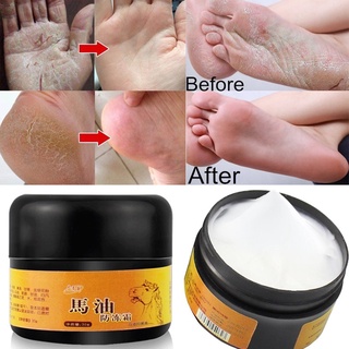 te 30g pies suaves picazón seco pie crema de grietas nutrir profundo cuidado de la piel ungüento (1)