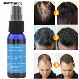 Snowspring Anti Hair Loss Growth Liquid Spray for Women Men Regrowth Repair Treatment Serum CL