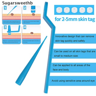 shb> tag band removedor de etiquetas de piel kit no tóxico cuidado facial mole verruga bandas de goma conjunto bien