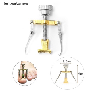 [baipestonwe] Ingrown Toenail Correction Tool Foot Toe Nail Care Clip Brace Pedicure Treatment ♨HOT SELL