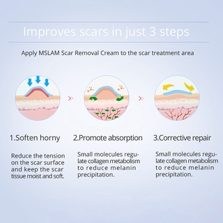 weimeiyu 20ml acné marca ungüento antialérgico suave extractos de plantas de acné eliminación de cicatrices crema de reparación de la piel para la belleza (9)