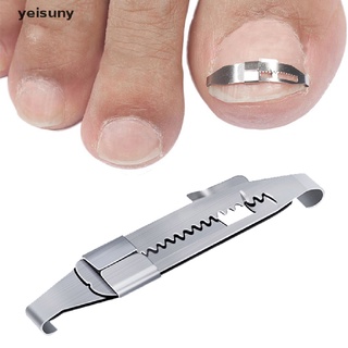 [Yei] Ingrown Toe foot Nail Correction Fixer Nail Pedicure Tool Toenail Corrector 586CL (1)