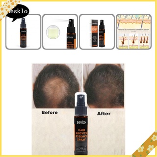 [SK] Spray líquido para crecimiento del cabello Regrowth Spray Anti pérdida producto nutritivo para adultos