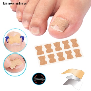 banyanshaw - adhesivo para corrección de uñas encarnadas, sin pegamento, sin ortodoncia, parche para pulgar cl