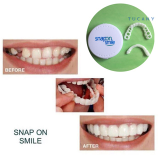 Tucany 2 pzs/juego de carillas de dentadura de dientes/cubiertas de prótesis dentales para clínica Dental (1)