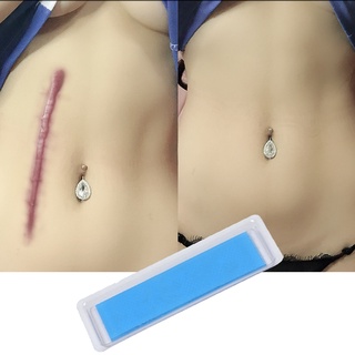 [tthouse]sección Cesárea hipertrófica queloide piel cicatrices tratamiento cicatrización parche de silicona hoja de Gel marcas de heridas