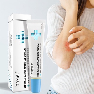 Anti-Sting Cream Eczema Urticaria Peeling Treatment Antibacterial Cream 20g