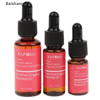 [bsf] aceite de rosa mosqueta certificado de piel orgánica aceite esencial puro y natural mejor aceite facial [baishangfly]