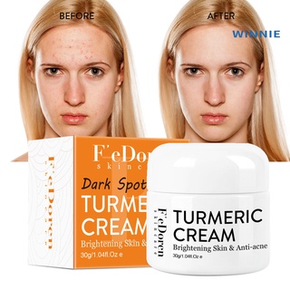 [winnie] 30g crema facial piel nutritiva blanquear acné cuidado de la piel crema reparadora para mujeres (2)