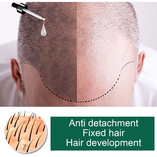 Eelhoe 30ml jengibre cuidado del cabello aceite esencial crecimiento del cabello líquido (4)