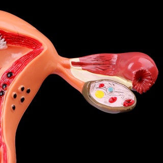 Chcool Útero Patológico Ovario Modelo Anatómico Anatomía Sección Transversal Herramienta De Estudio (8)