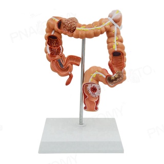 Teaching el Human Large Intestine Anatomical el Visceral Colon and Rectum Pathological el for School Hospital