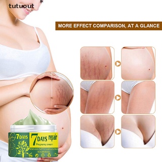 Tutuout Maternity Skin Repair Smooth Skin Cream For Stretch Marks Scar Removal Care CL