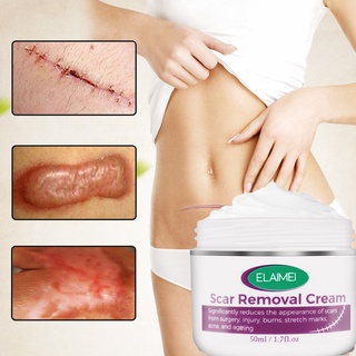 geanmiu 50ml crema cicatrizante fácil de absorber se desvanecen cicatrices cuidado de la piel cicatrización piel estiramiento tratamiento para parte del cuerpo