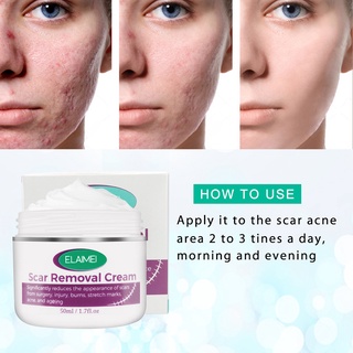 bansubu 50ml crema cicatrizante fácil de absorber se desvanecen cicatrices cuidado de la piel cicatrización piel estiramiento tratamiento para parte del cuerpo (8)