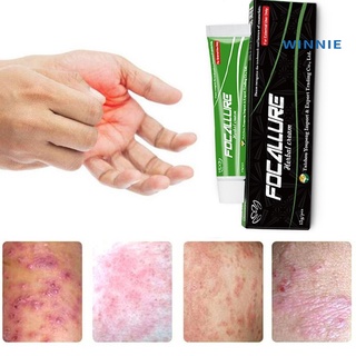 [winnie] natural herbal anti psoriasis crema corporal dermatitis eczema tratamiento ungüento (3)