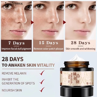 [sxm] crema de pecas blanqueamiento de la piel de plantas de hierbas crema facial eliminar pecas manchas oscuras uyk (3)