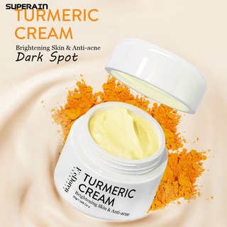 superain 30g crema facial piel nutritiva blanquear el acné cuidado de la piel hidratantes reparación de la crema para las mujeres (4)
