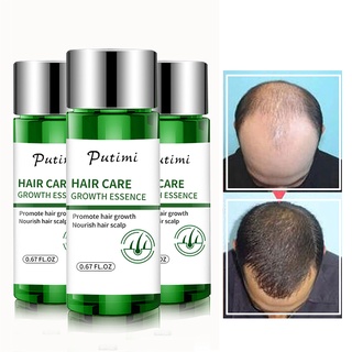 te 20ml esencia de crecimiento del cabello hidratante antipérdida tratamiento del cuero cabelludo aceite esencial (2)