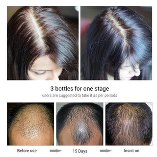 caliente 20ml crecimiento del cabello esencia aceite pelo barba crecimiento suero anti-pérdida de cabello productos (4)