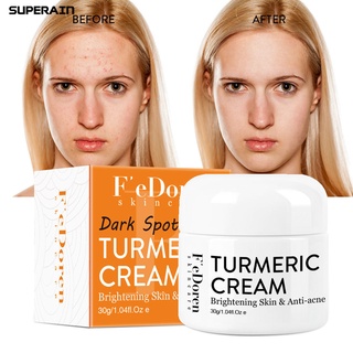 superain 30g crema facial piel nutritiva blanquear el acné cuidado de la piel hidratantes reparación de la crema para las mujeres (2)