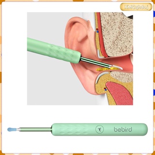 hd wireless ear wax removal endoscopio otoscopio cámara earpick recargable